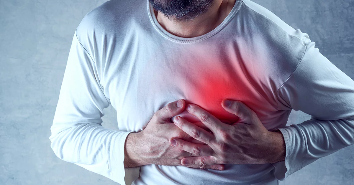 Heart Attack (Myocardial Infarction)